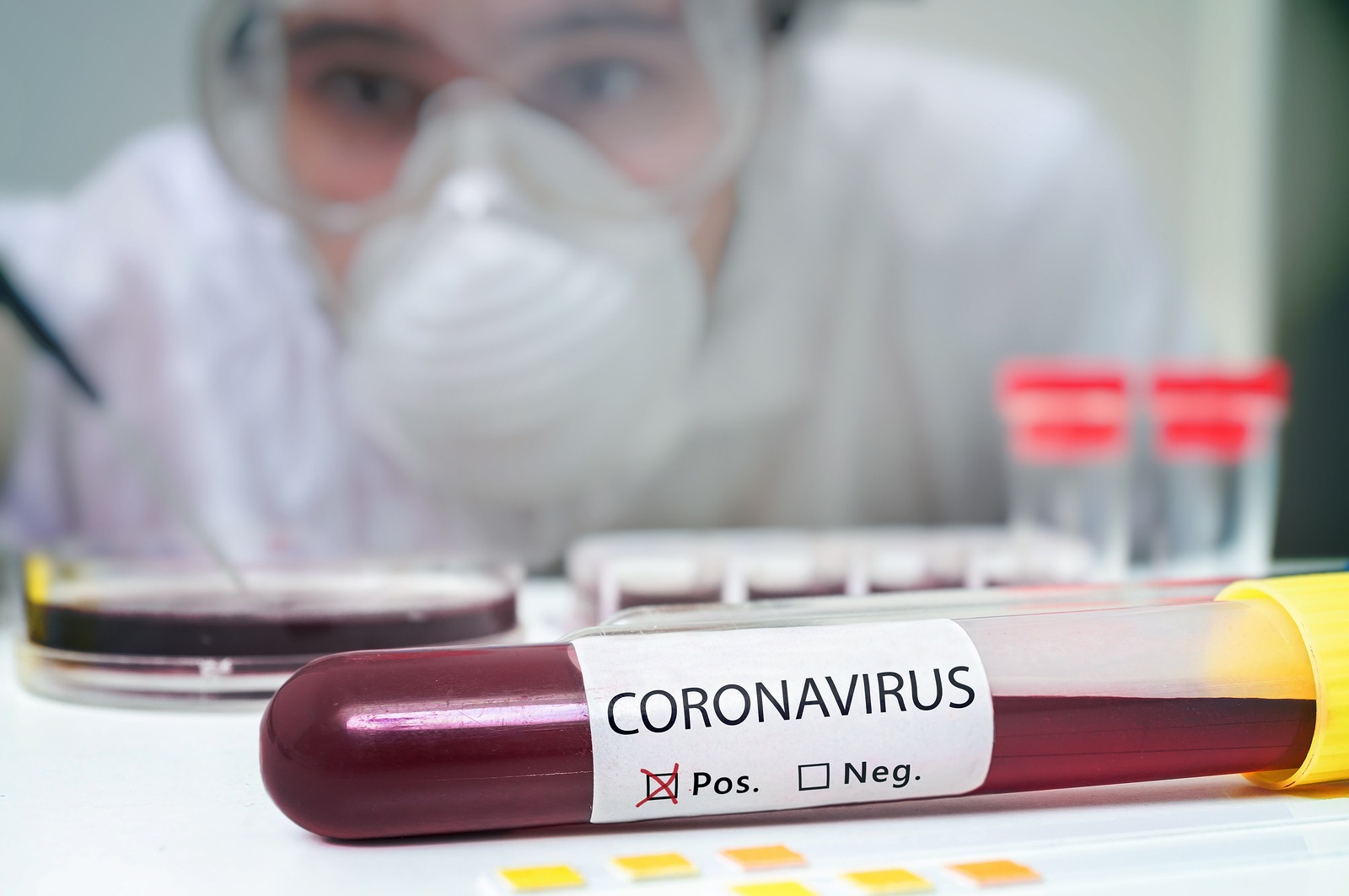 Researcher in laboratory is analyzing blood sample in test tube for Coronavirus test.