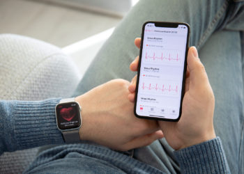 Apple Watch EKG