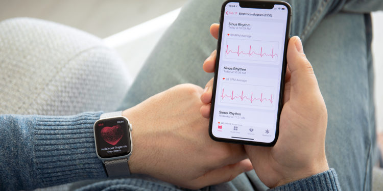 Apple Watch EKG